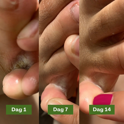 BioClean™ Antifungal Kroppsbar