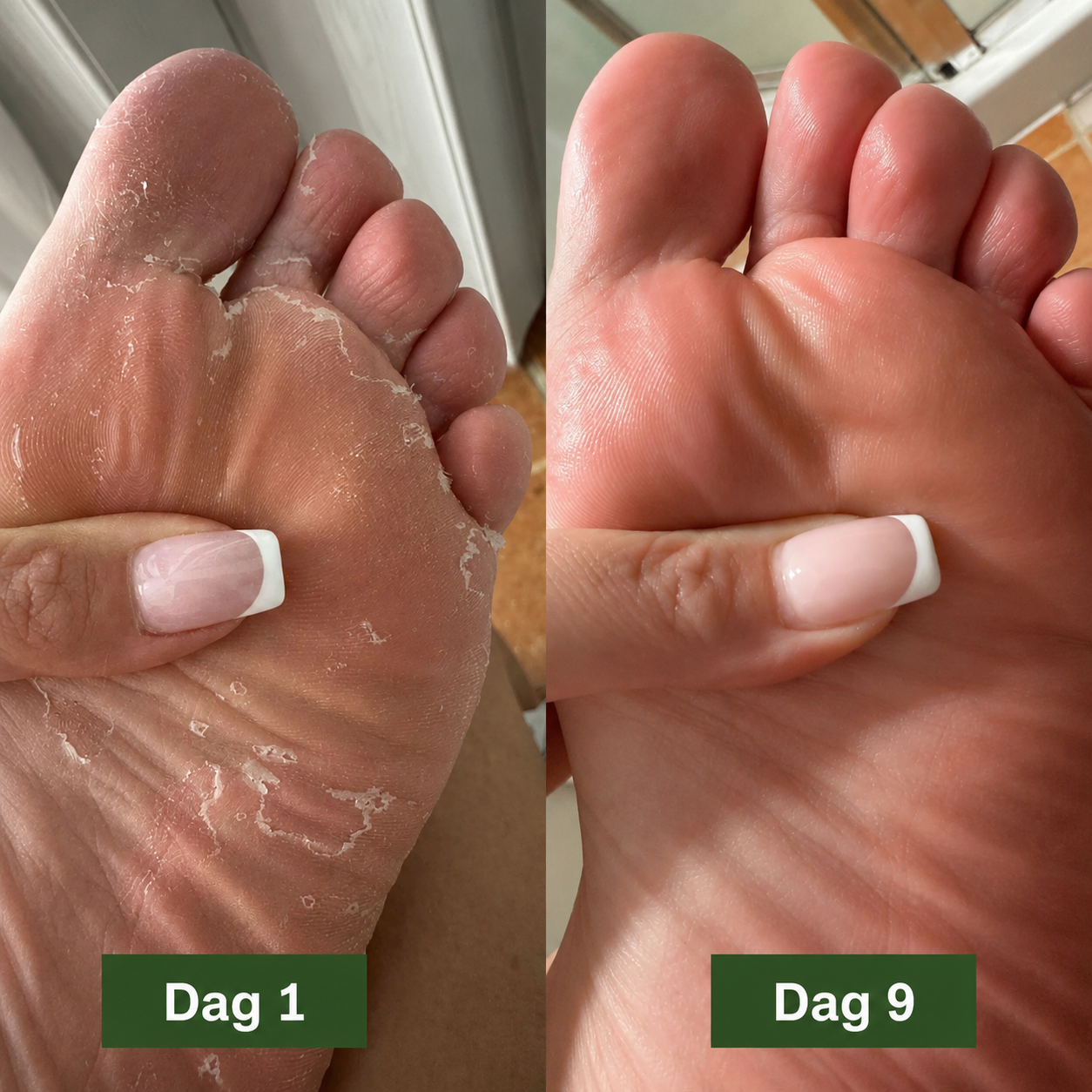 BioClean™ Antifungal Kroppsbar