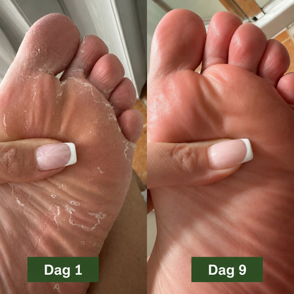 BioClean™ Antifungal Kroppsbar