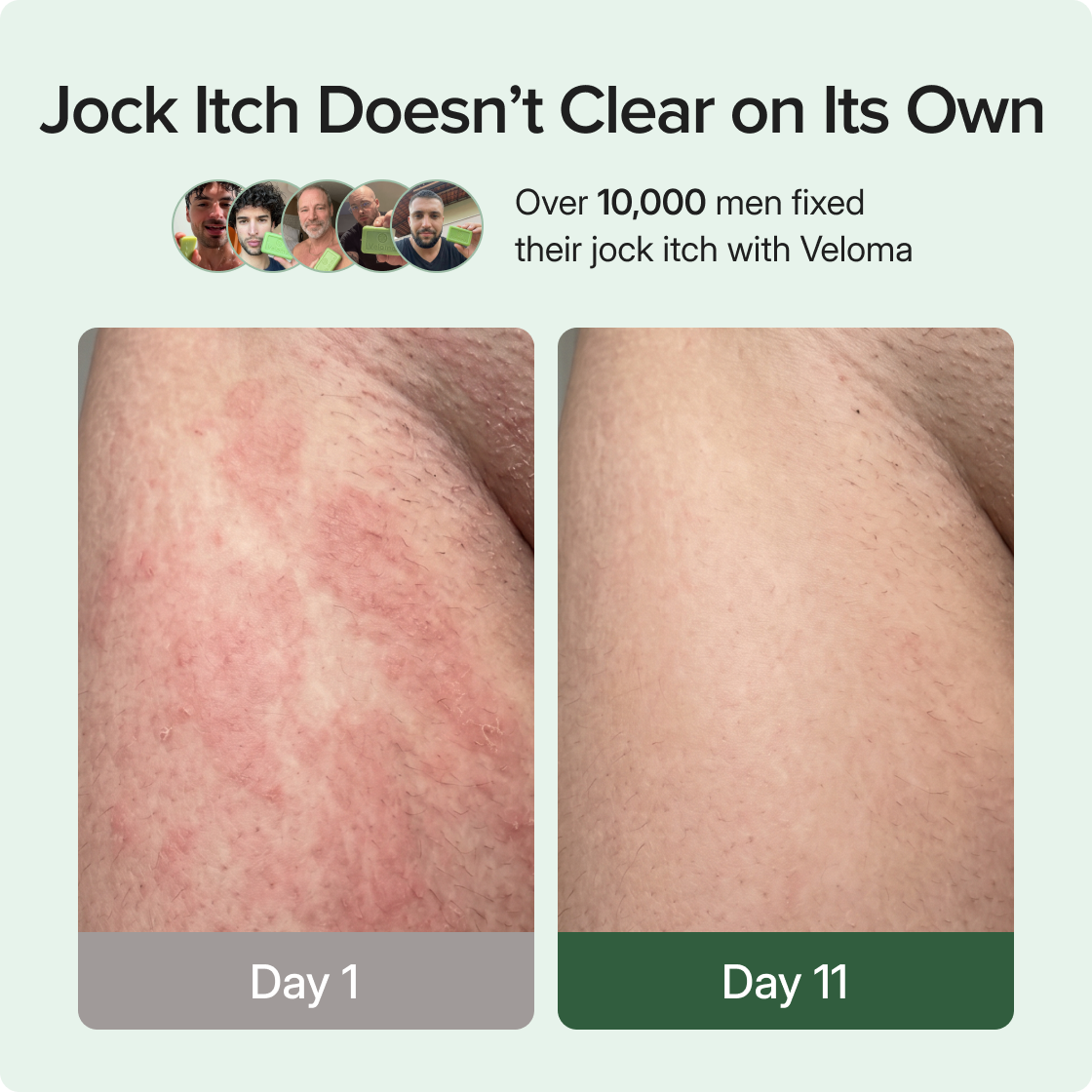 BioClean Antifungal Tvål